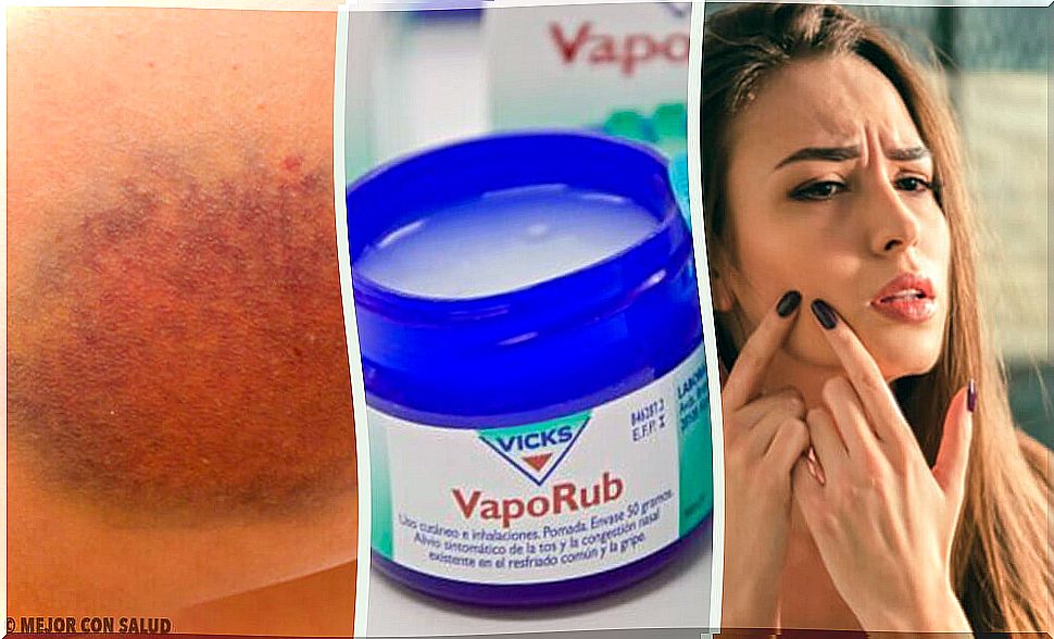 11 surprising things you can use Vicks VapoRub for