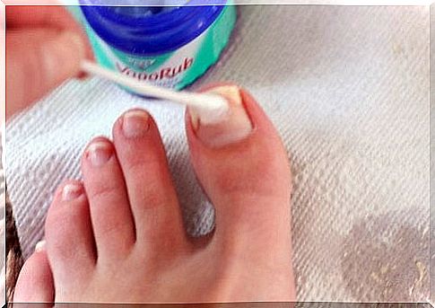 Person applying vaporub on nail