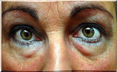 Woman with wrinkles and bags under the eyes