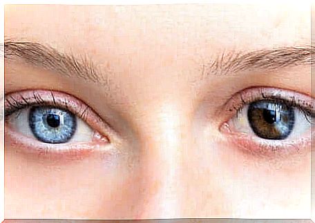 Illustration of change in eye color