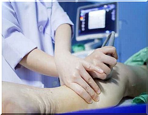 Deep vein thrombosis: How to detect and prevent it