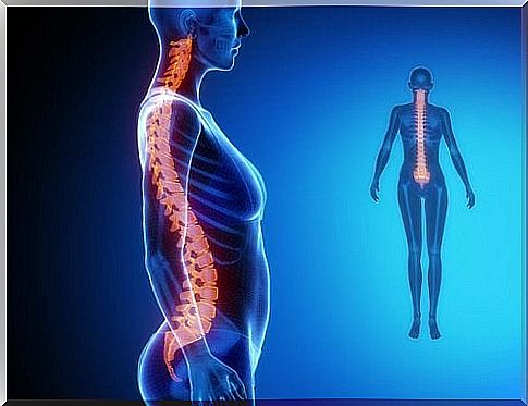 Picture of woman with spine