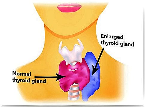 Some foods can help stimulate the thyroid gland