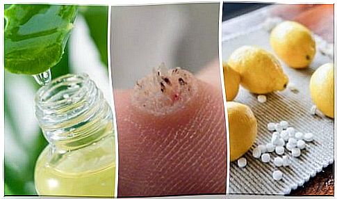 Get rid of warts with these 6 powerful remedies