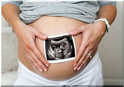 Pregnant woman with scan image on her belly