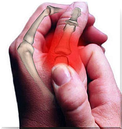 Person with osteoarthritis of the thumb