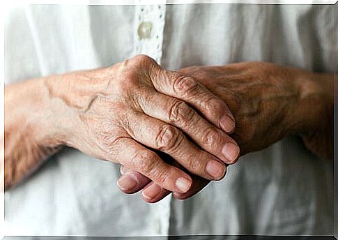 Elderly person with osteoarthritis of the hands