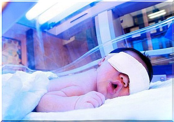 an infant receives treatment with light