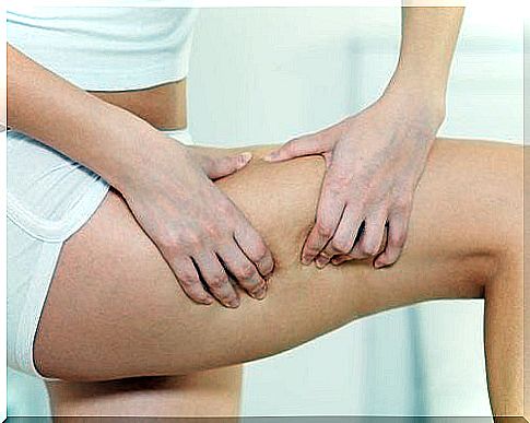 Thigh Cellulitis