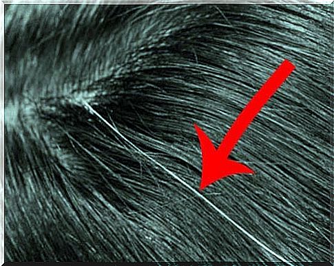 Tips to avoid getting gray hair prematurely