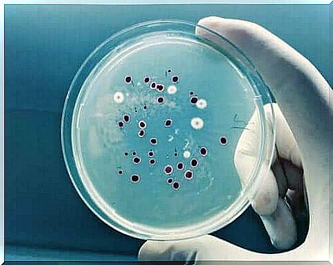 Stool sample is used to examine bacteria