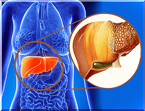 What is hepatic steatosis?  How is it treated?